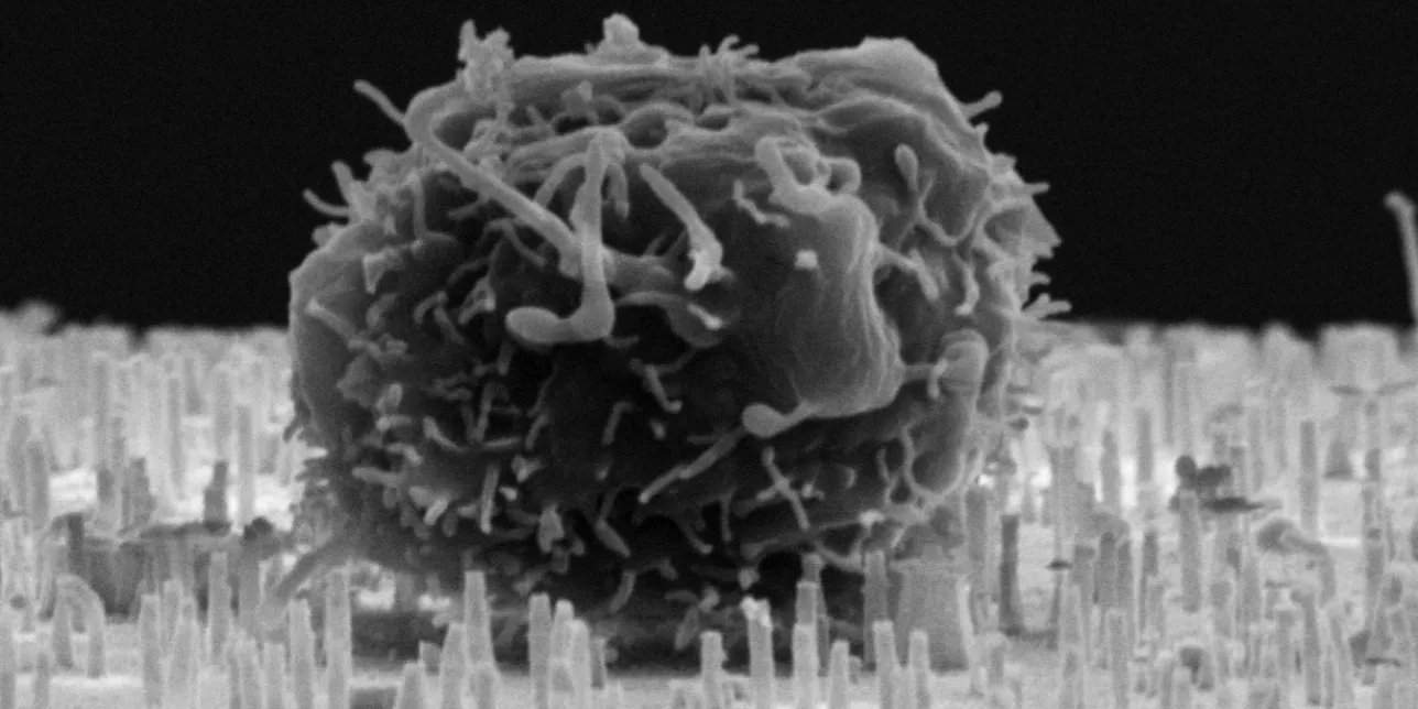 Electron microscope image showing a blood stem cell on top of a membrane with nanotubes. Photo: M. Hjort and L. Schmiderer