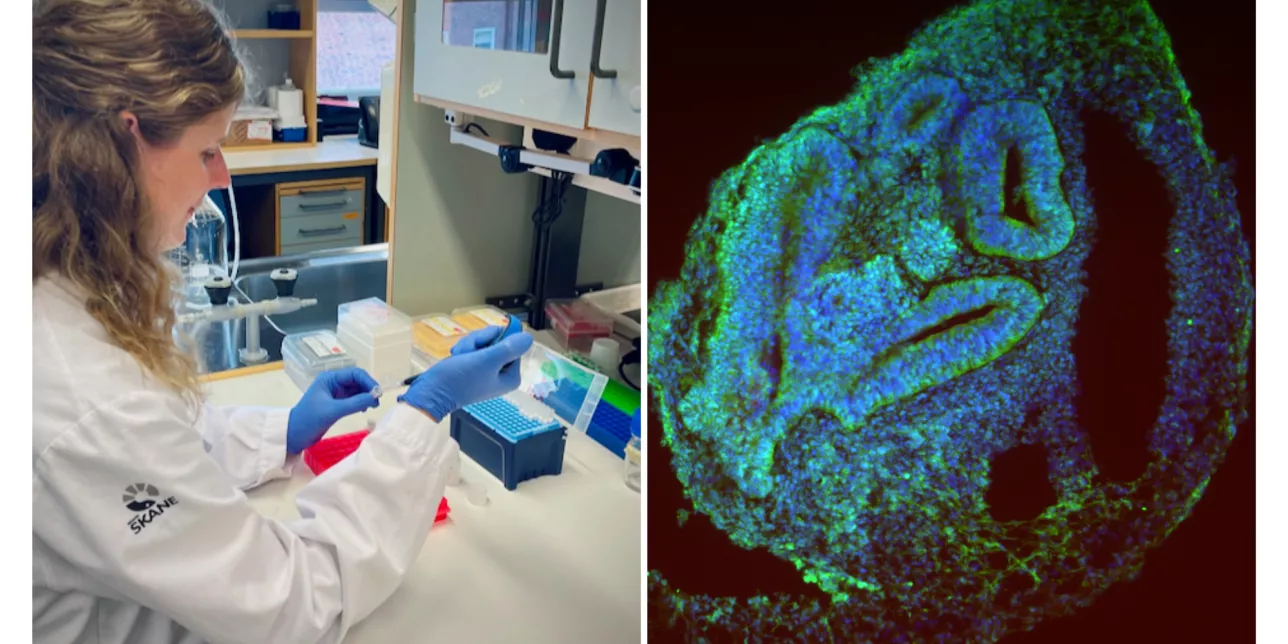 A photo collage with a photo of Patricia Gerdes at work in the lab (left) and a fluorescence image of a rhesus macaque organoid in blue/green (right). 