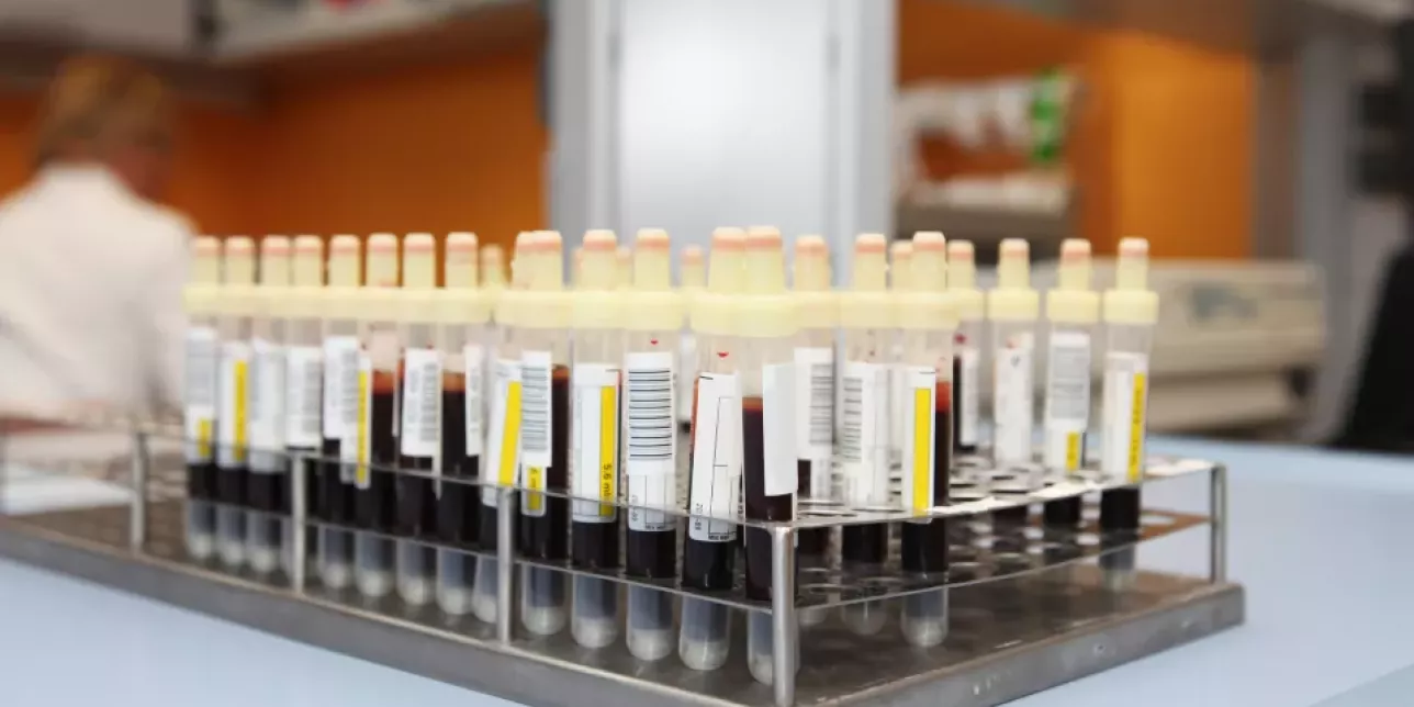 Photo of a group of blood samples