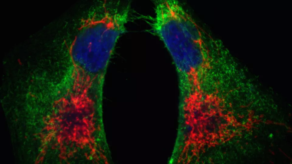 Image of breast cancer cells expressing a stem cell marker (CD44, green signal) and sporting richly interwoven mitochondrial networks (red). Image credit Maciej Ciesla.