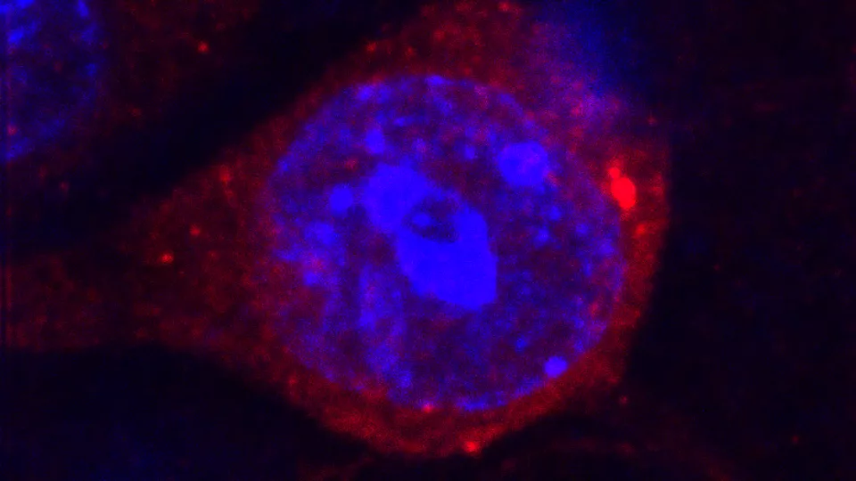 A high power microscopy image of a neuron (blue) in which the epigenetic silencing of ERVs are lost, resulting in abundant ERV proteins (red). Photo credit: Marie Jönsson.