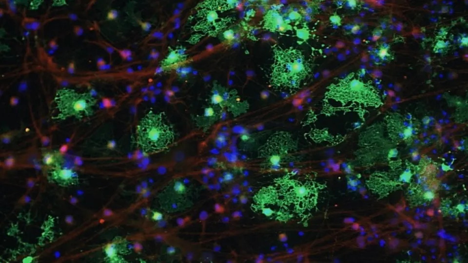 Fluorescent microscope image of control MBP-positive oligodendrocytes (in green) co-stained with alpha-synuclein (in red). It is possible to observe neurites positive for alpha-synuclein. Photo Credit: Carla Azevedo.