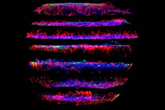 An image of humanized ossicles