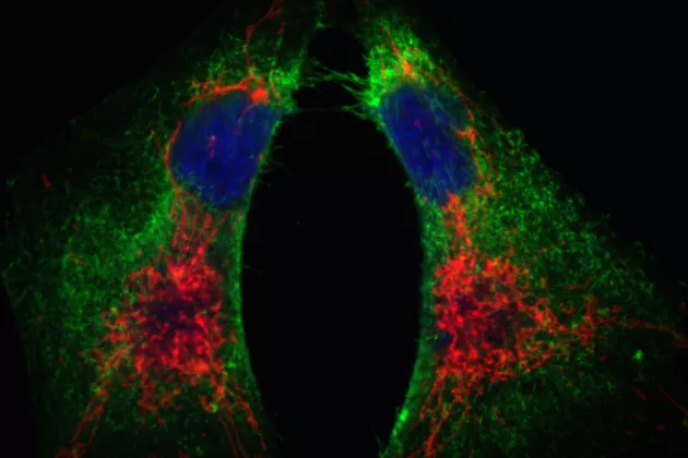 Image of breast cancer cells expressing a stem cell marker (CD44, green signal) and sporting richly interwoven mitochondrial networks (red). Image credit Maciej Ciesla.