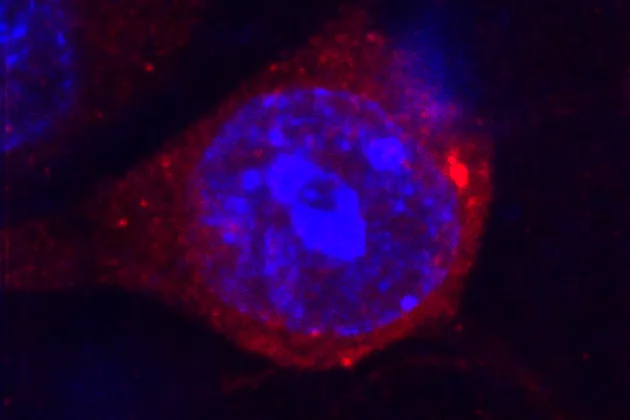 A high power microscopy image of a neuron (blue) in which the epigenetic silencing of ERVs are lost, resulting in abundant ERV proteins (red). Photo credit: Marie Jönsson.