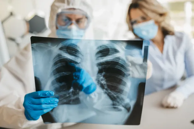 New model of human airways speeds up the battle against Covid-19 
