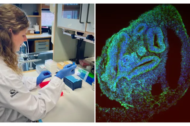 A photo collage with a photo of Patricia Gerdes at work in the lab (left) and a fluorescence image of a rhesus macaque organoid in blue/green (right). 