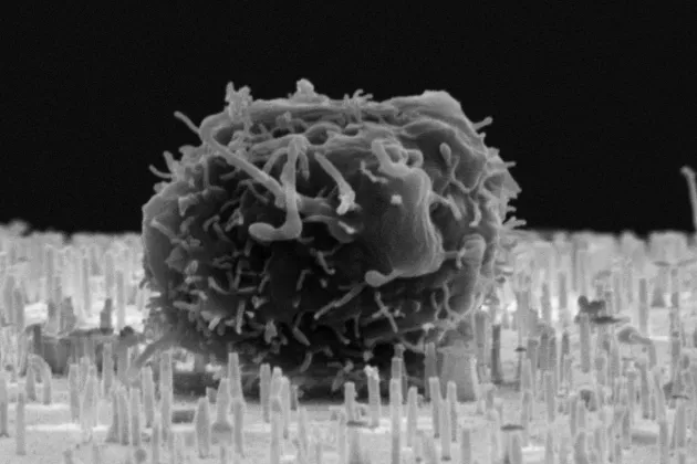Electron microscopy image of hematopoietic stem/progenitor cell on top of nanostraws. Image credit: M. Hjort and L. Schmiderer