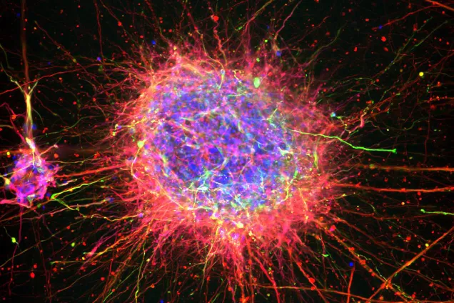 Nerve cells created from stem cells. Photo: Janko Kajtez/ Kirkeby Group