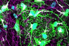 An image of co-cultures with neuronal projections in purple and astrocytes in green. Image credit: Isaac Canals.
