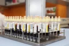 Photo of a group of blood samples
