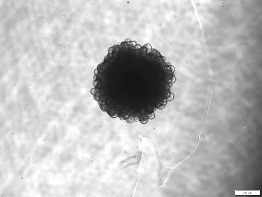An image of a chimpanzee organoid, in black and white.
