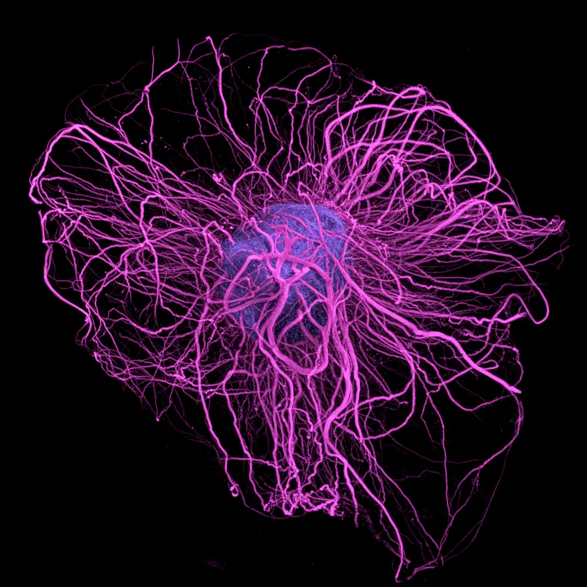 Dopamine neurons grown in 3D in culture Photo: Parmar lab, Lund University.